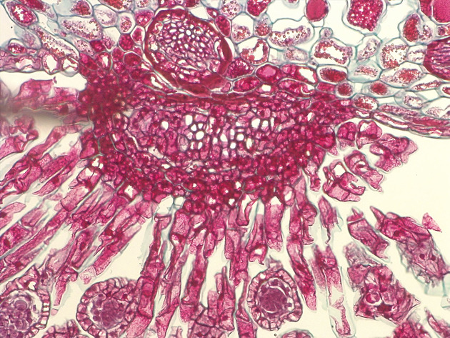 Mature Sporangia Slides - Mature Sporangia 04 200X